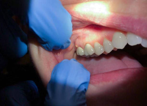 Best Holiday Emergency Dentist in Martinsvle, IL