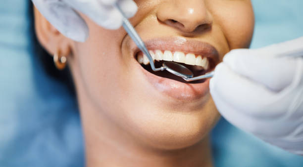 Best Emergency Dental Extractions in Martinsvle, IL
