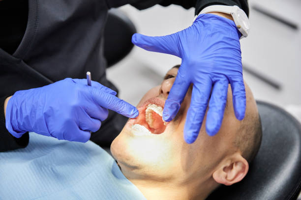 Best Emergency Root Canal Treatment in Martinsvle, IL